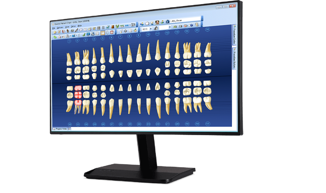 Dentrix PMS System
